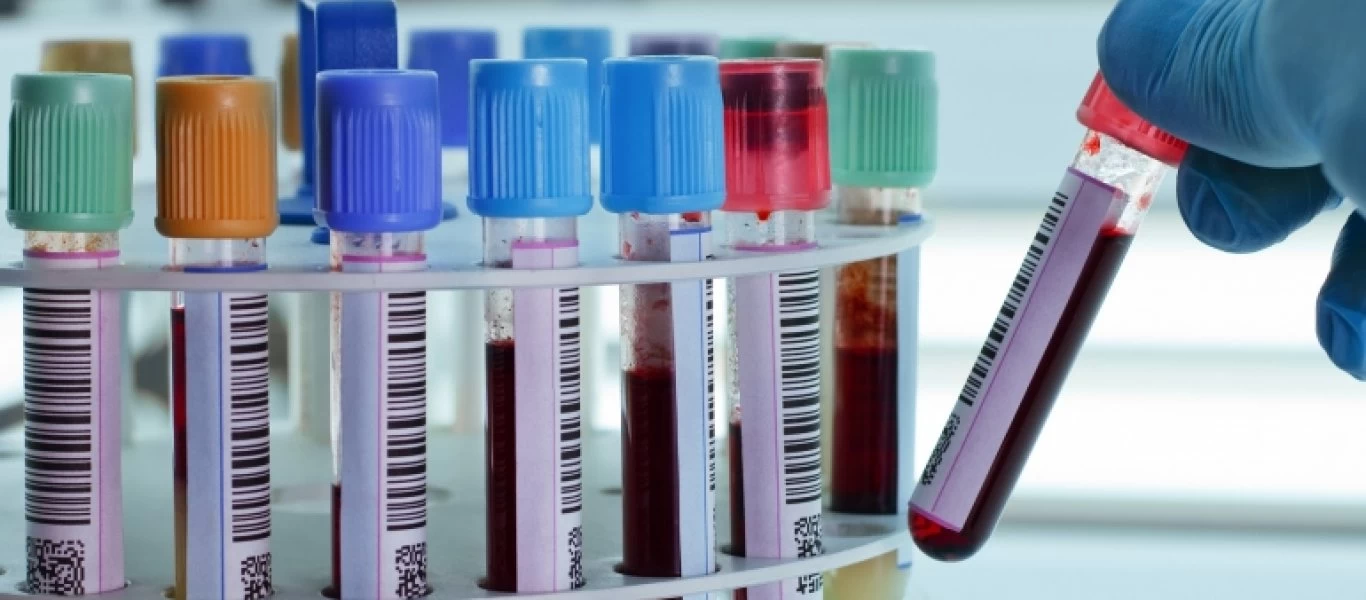 Tι είναι η θρομβοκυττάρωση και πώς αντιμετωπίζεται;